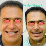 دکتر آیت پوزش در شیراز