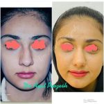 دکتر آیت پوزش در شیراز