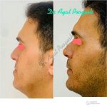 دکتر آیت پوزش در شیراز