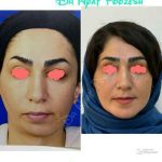 دکتر آیت پوزش در شیراز