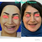 دکتر آیت پوزش در شیراز