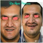 دکتر آیت پوزش در شیراز