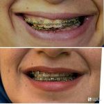 دکتر آیت پوزش در شیراز