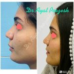 دکتر آیت پوزش در شیراز