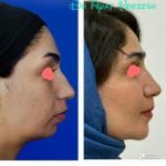 دکتر آیت پوزش در شیراز