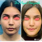 دکتر آیت پوزش در شیراز