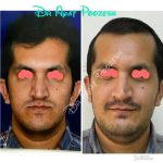 دکتر آیت پوزش در شیراز