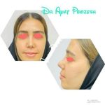 دکتر آیت پوزش در شیراز