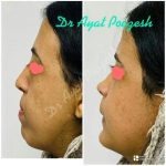 دکتر آیت پوزش در شیراز