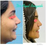 دکتر آیت پوزش در شیراز