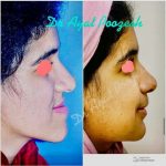 دکتر آیت پوزش در شیراز