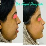 دکتر آیت پوزش در شیراز