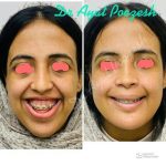 دکتر آیت پوزش در شیراز