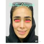 دکتر آیت پوزش در شیراز