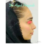 دکتر آیت پوزش در شیراز