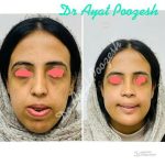 دکتر آیت پوزش در شیراز