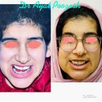 دکتر آیت پوزش در شیراز