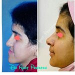 دکتر آیت پوزش در شیراز