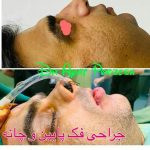 دکتر آیت پوزش در شیراز