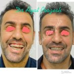 دکتر آیت پوزش در شیراز