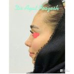 دکتر آیت پوزش در شیراز