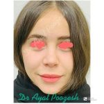 دکتر آیت پوزش در شیراز