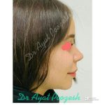 دکتر آیت پوزش در شیراز