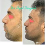 دکتر آیت پوزش در شیراز