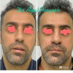 دکتر آیت پوزش در شیراز