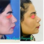 دکتر آیت پوزش در شیراز