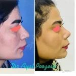دکتر آیت پوزش متخصص جراحی دهان فک و صورت در شیراز