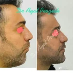 دکتر آیت پوزش متخصص جراحی دهان فک و صورت در شیراز