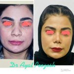 دکتر آیت پوزش در شیراز