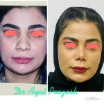 دکتر آیت پوزش متخصص جراحی دهان فک و صورت در شیراز