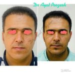 دکتر آیت پوزش در شیراز