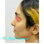 دکتر آیت پوزش متخصص جراحی دهان فک و صورت در شیراز