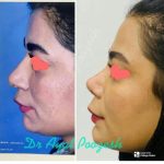 دکتر آیت پوزش در شیراز