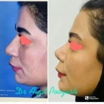 دکتر آیت پوزش متخصص جراحی دهان فک و صورت در شیراز