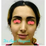 دکتر آیت پوزش متخصص جراحی دهان فک و صورت در شیراز