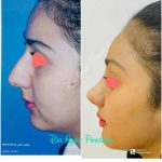 دکتر آیت پوزش در شیراز