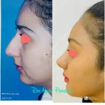 دکتر آیت پوزش متخصص جراحی دهان فک و صورت در شیراز