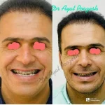 دکتر آیت پوزش متخصص جراحی دهان فک و صورت در شیراز