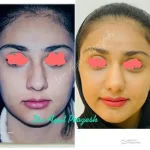 دکتر آیت پوزش متخصص جراحی دهان فک و صورت در شیراز