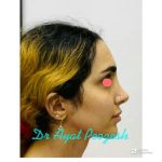 دکتر آیت پوزش در شیراز