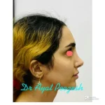 دکتر آیت پوزش متخصص جراحی دهان فک و صورت در شیراز