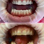 دکتر یلدا حاجی عباسی در رشت