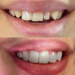 دکتر یلدا حاجی عباسی در رشت