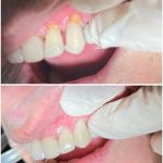 دکتر یلدا حاجی عباسی در رشت