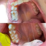 دکتر یلدا حاجی عباسی در رشت