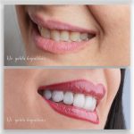 دکتر یلدا حاجی عباسی در رشت